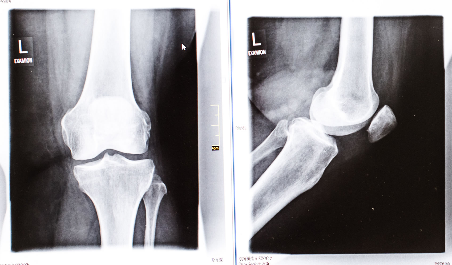 Zwei Standorte in Pohlheim im Landkreis Giessen und Butzbach